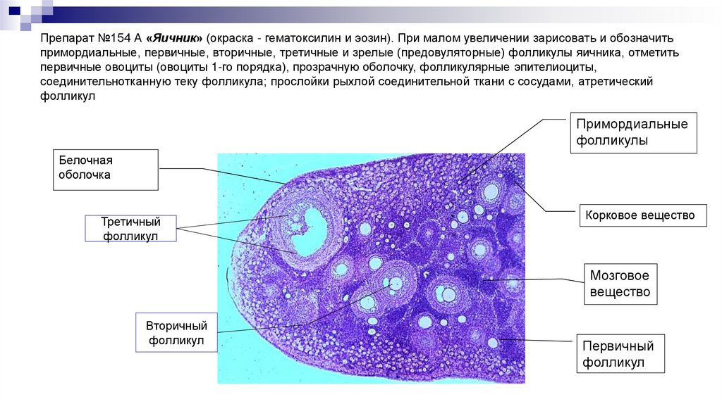 Препарат №154 А «Яичник» (окраска - гематоксилин и эозин). При малом увеличении зарисовать и обозначить примордиальные,