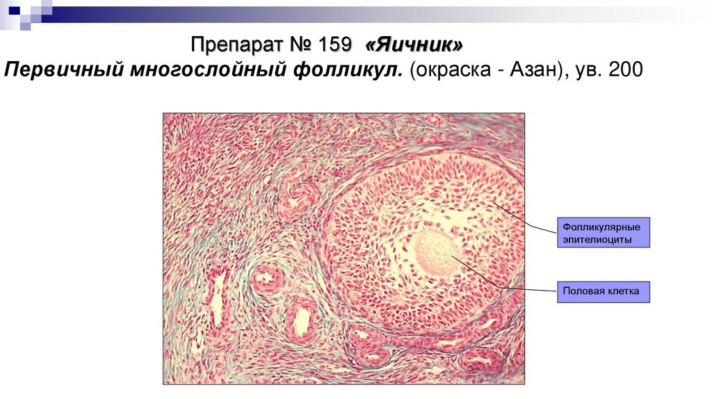 Препарат № 159 «Яичник» Первичный многослойный фолликул. (окраска - Азан), ув. 200