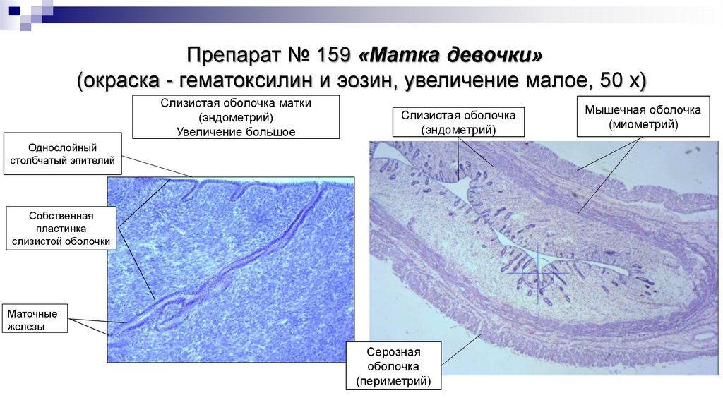 Препарат № 159 «Матка девочки» (окраска - гематоксилин и эозин, увеличение малое, 50 х)