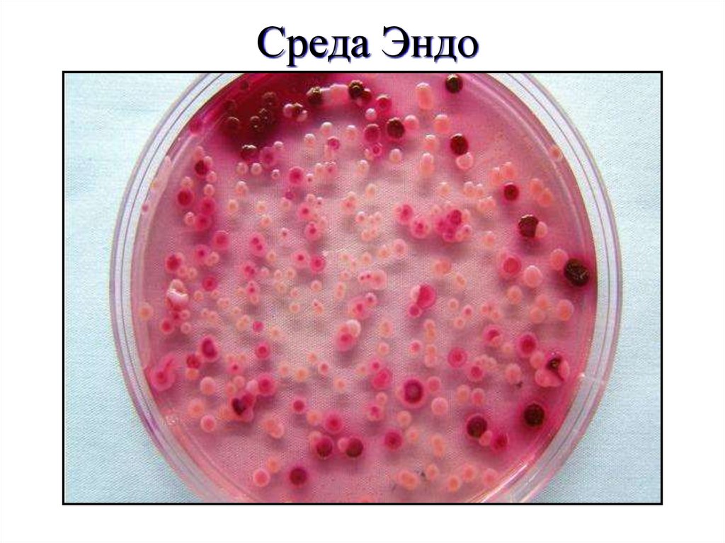 Среда Эндо