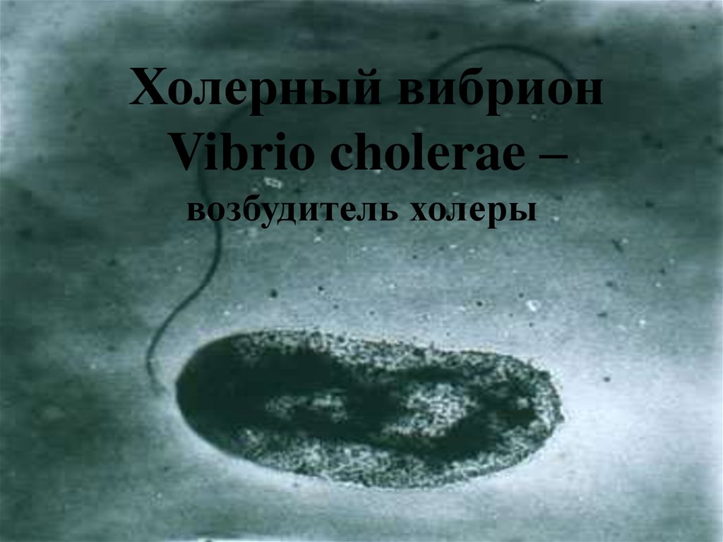 Холерный вибрион Vibrio cholerae – возбудитель холеры