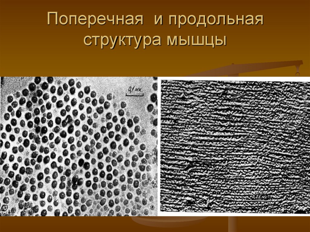 Поперечная и продольная структура мышцы