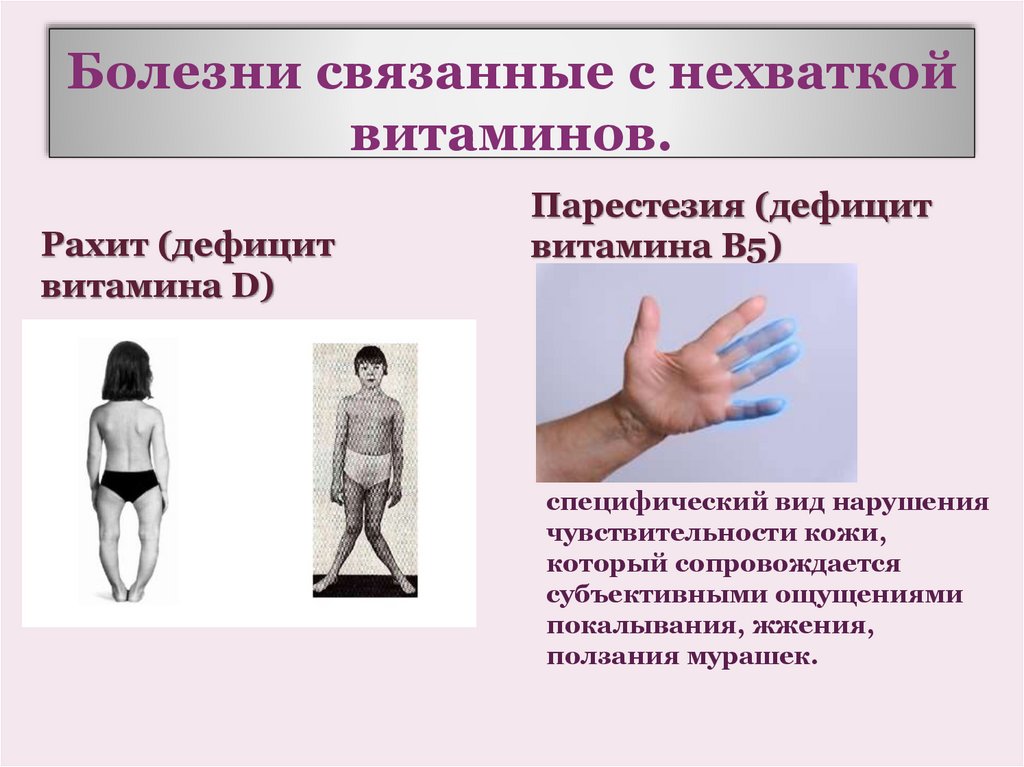 Болезни связанные с нехваткой витаминов.