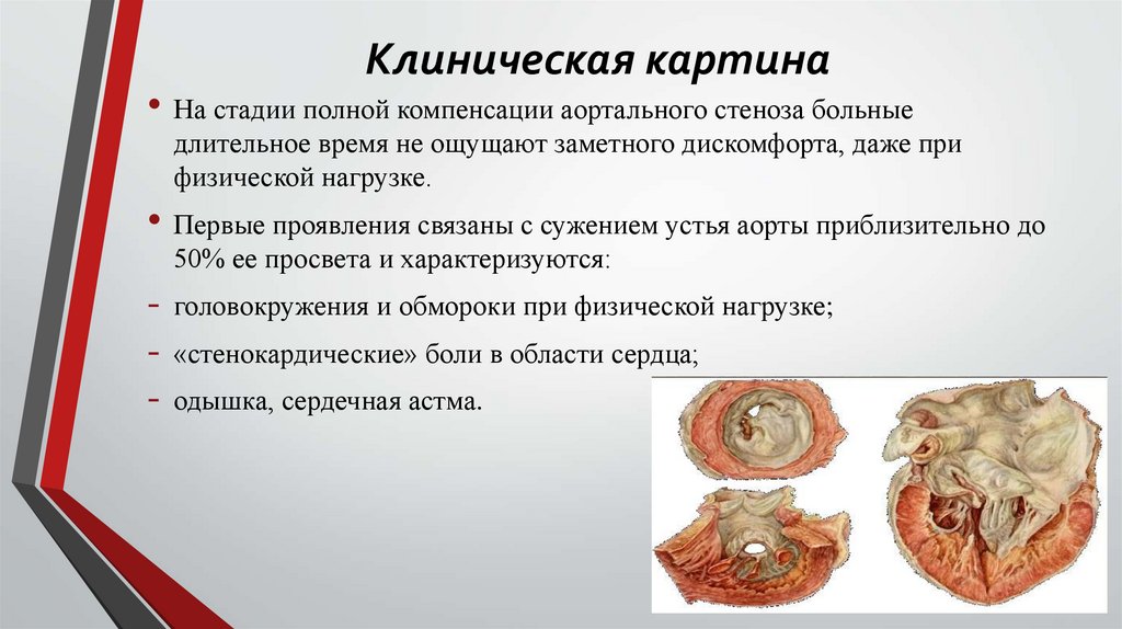 Клиническая картина