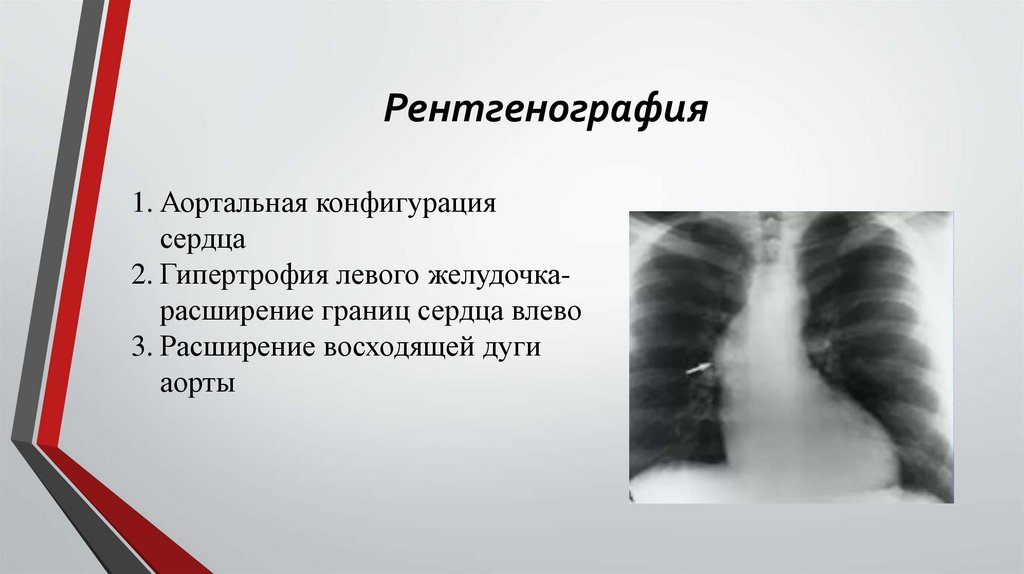 Рентгенография