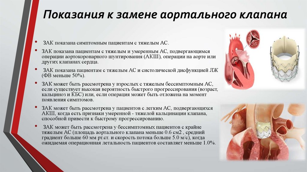 Показания к замене аортального клапана