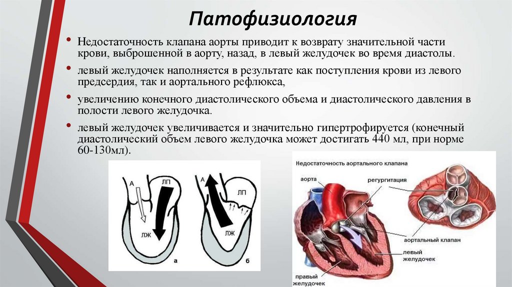 Патофизиология