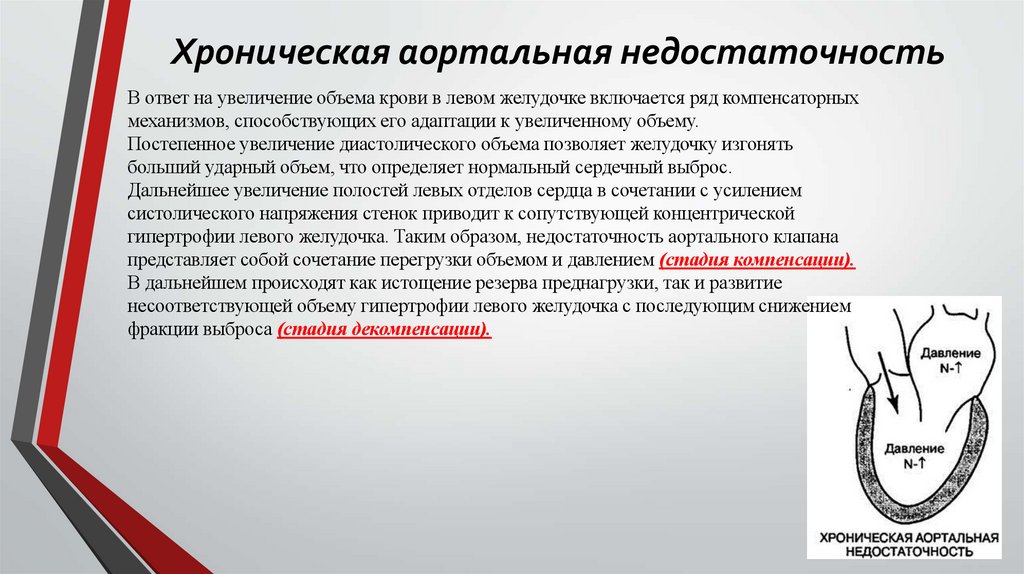 Хроническая аортальная недостаточность