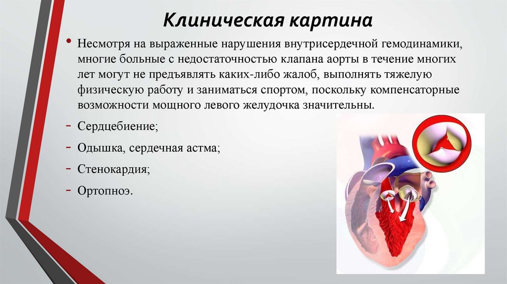 Клиническая картина