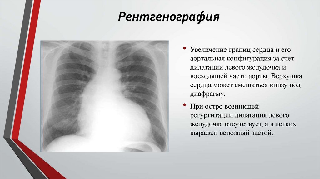 Рентгенография