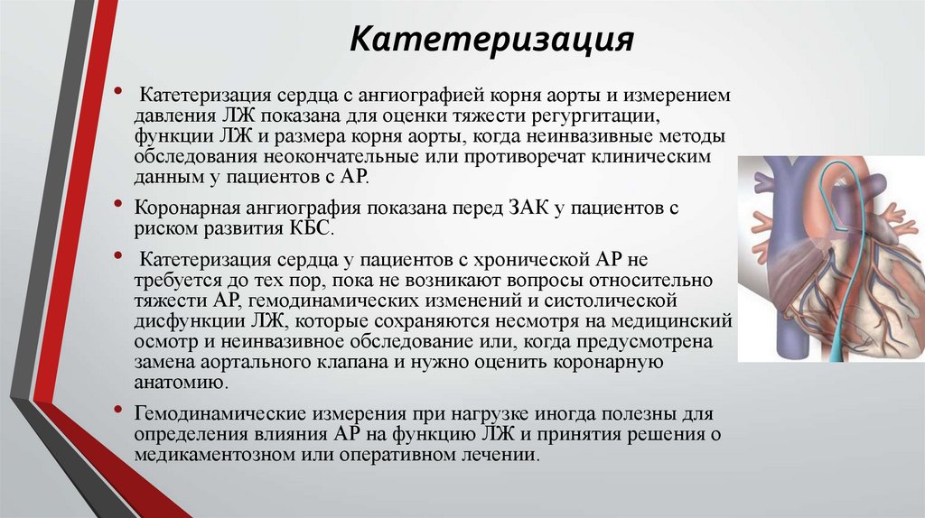 Катетеризация