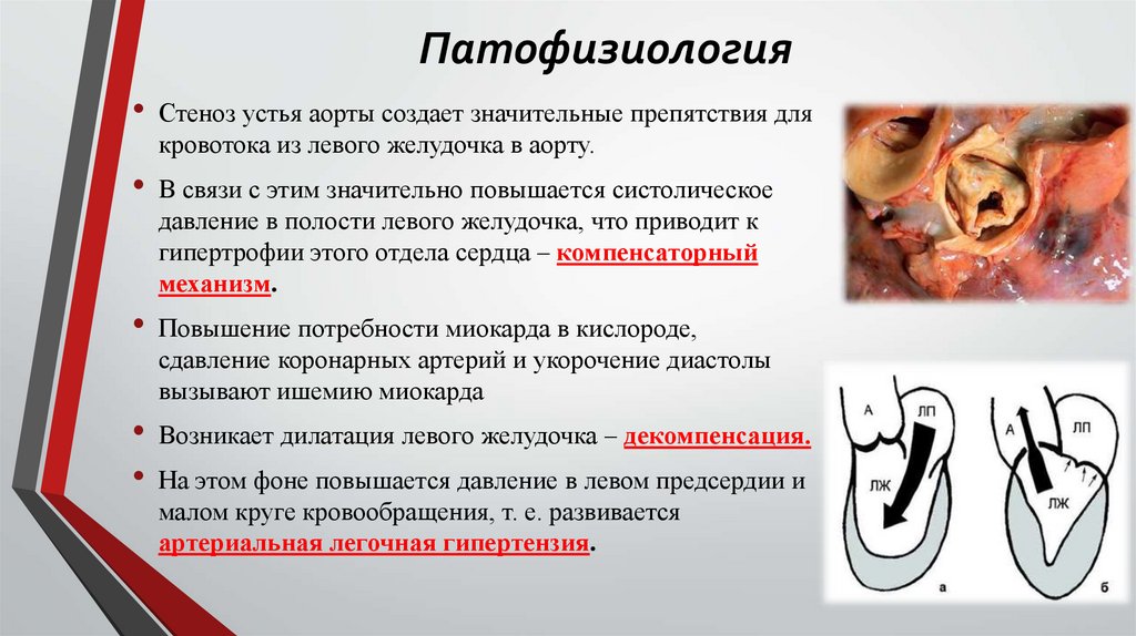 Патофизиология