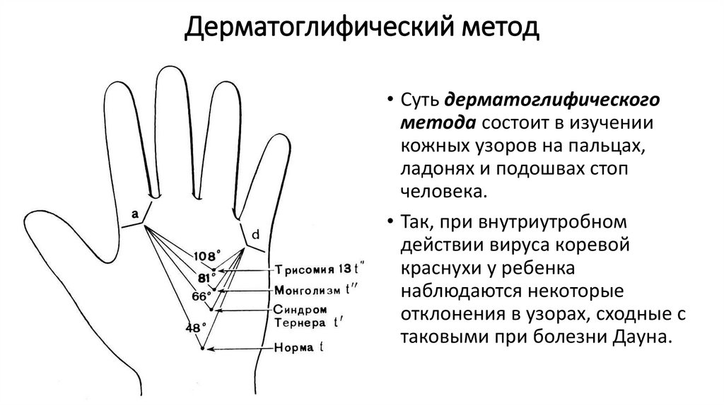 Дерматоглифический метод