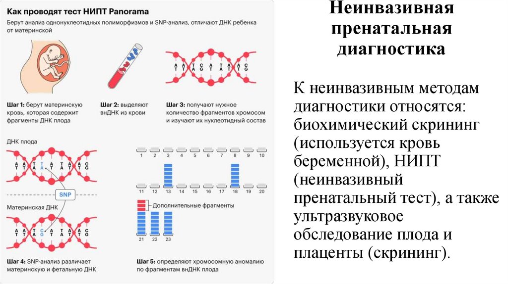 Неинвазивная пренатальная диагностика