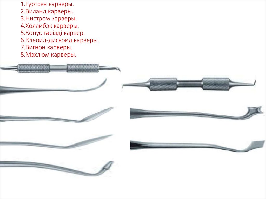 1.Гуртсен карверы. 2.Виланд карверы. 3.Нистром карверы. 4.Холлибэк карверы. 5.Конус тәрізді карвер. 6.Клеоид-дискоид карверы.