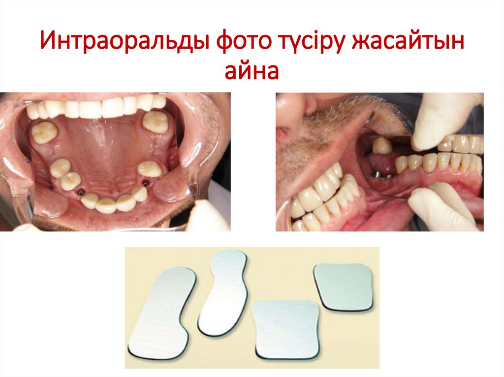Интраоральды фото түсіру жасайтын айна