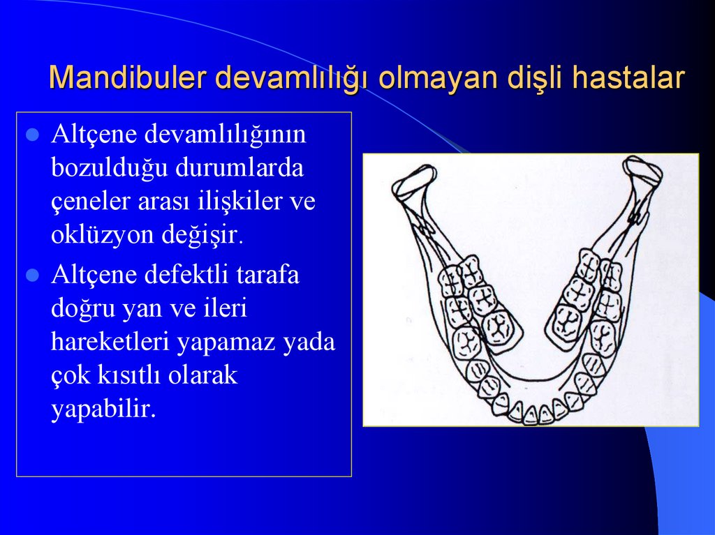 Mandibuler devamlılığı olmayan dişli hastalar