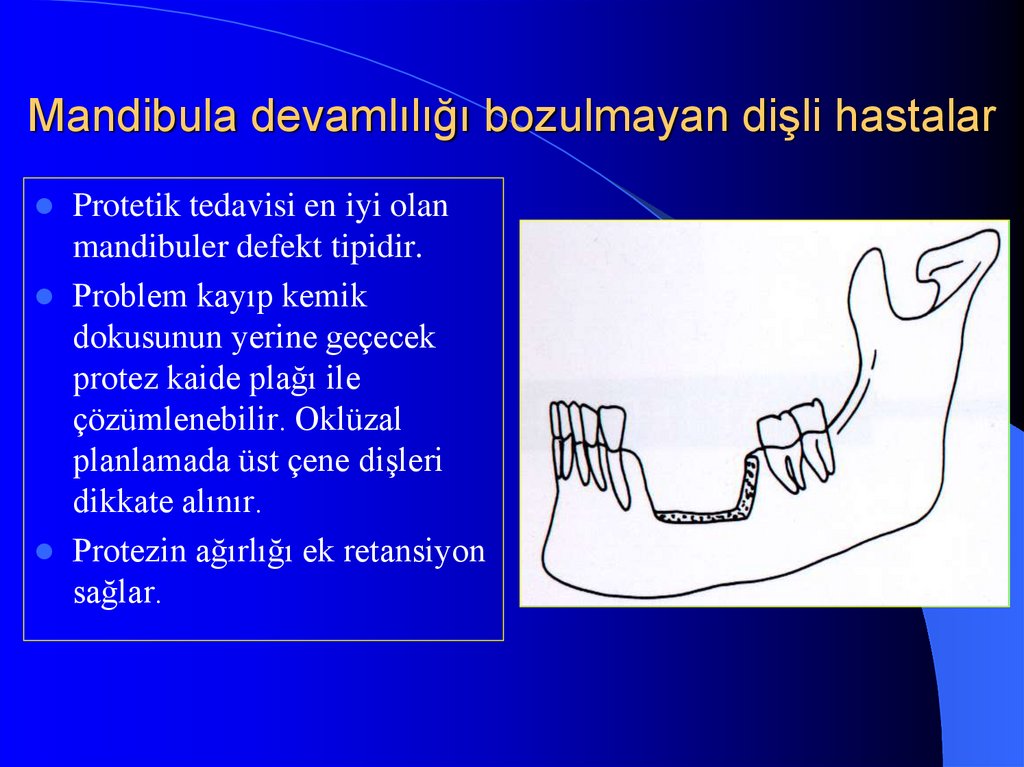 Mandibula devamlılığı bozulmayan dişli hastalar