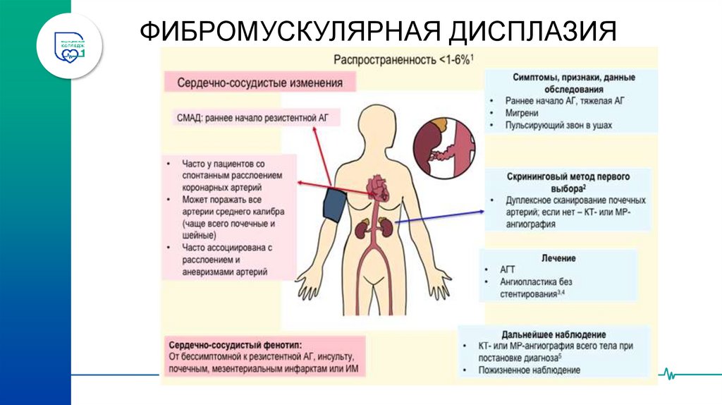 АТЕРОСКЛЕРОЗ ПОЧЕЧНЫХ АРТЕРИЙ