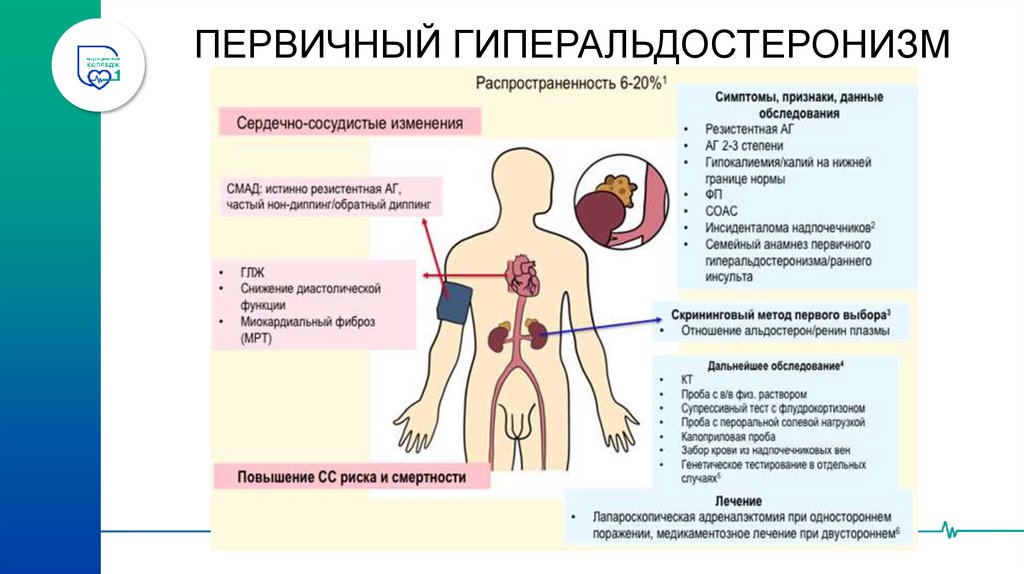 ФИБРОМУСКУЛЯРНАЯ ДИСПЛАЗИЯ