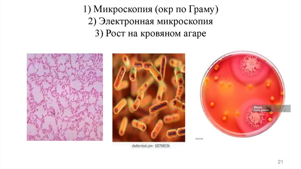 1) Микроскопия (окр по Граму) 2) Электронная микроскопия 3) Рост на кровяном агаре