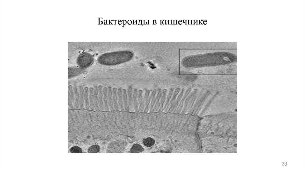 Бактероиды в кишечнике