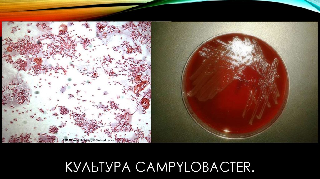 Культура Campylobacter.