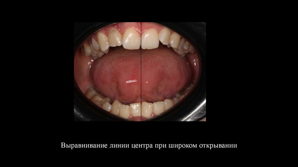 Выравнивание линии центра при широком открывании