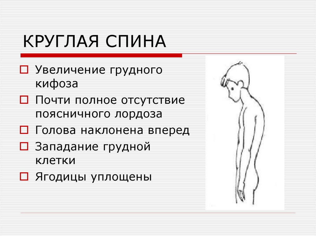 КРУГЛАЯ СПИНА