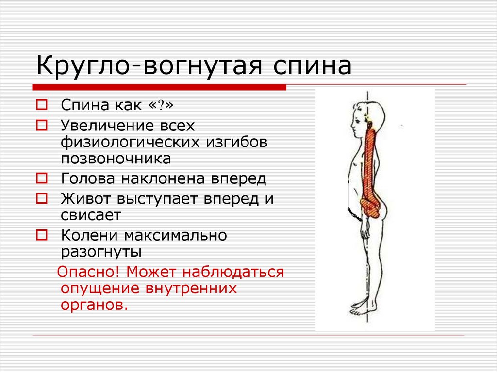 Кругло-вогнутая спина