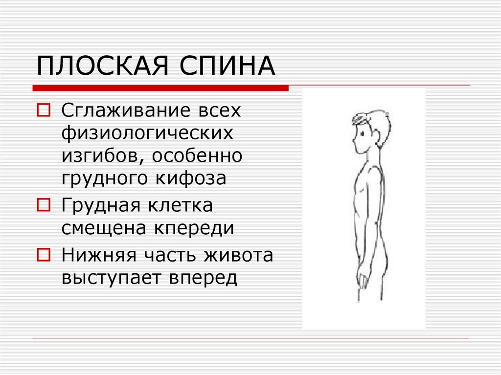 ПЛОСКАЯ СПИНА