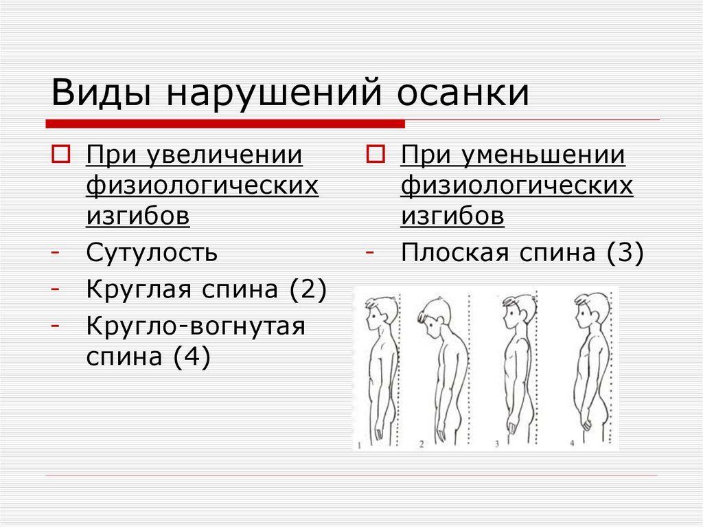 Виды нарушений осанки