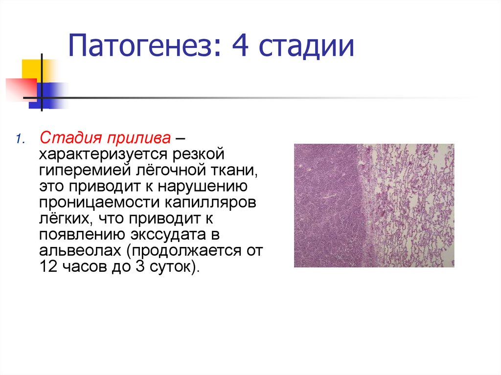 Патогенез: 4 стадии