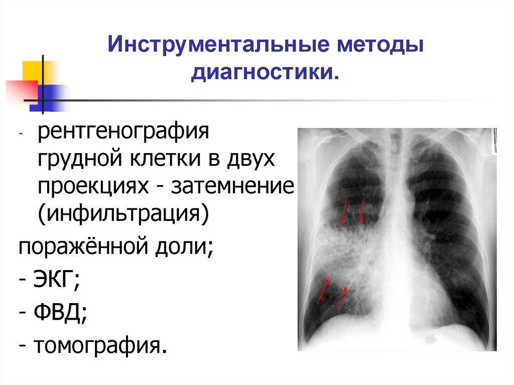 Инструментальные методы диагностики.