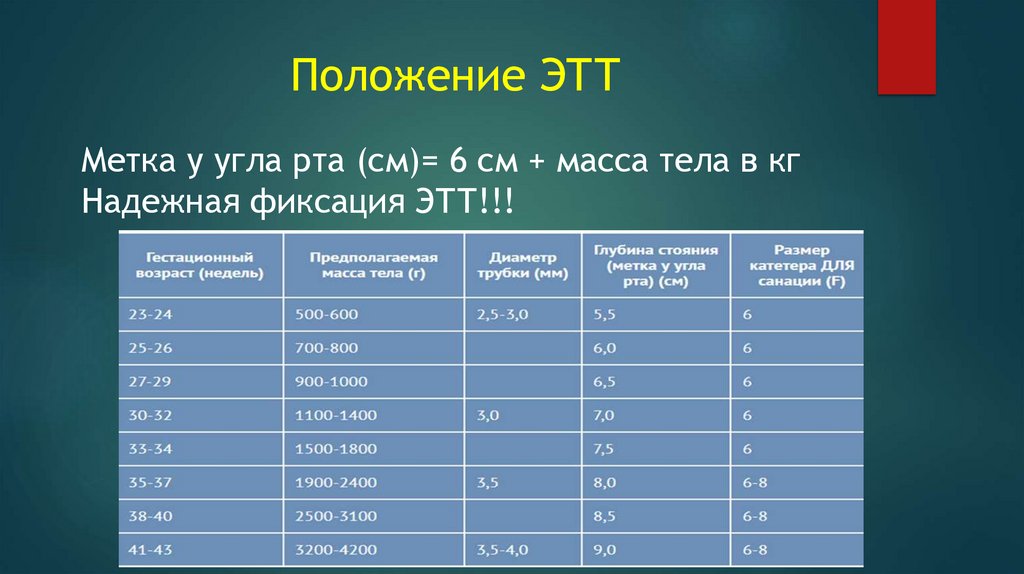 Положение ЭТТ