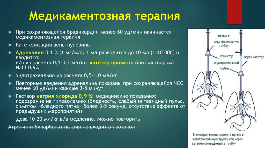 Медикаментозная терапия