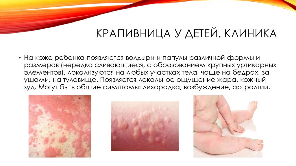 Неотложная помощь. стеноз гортани