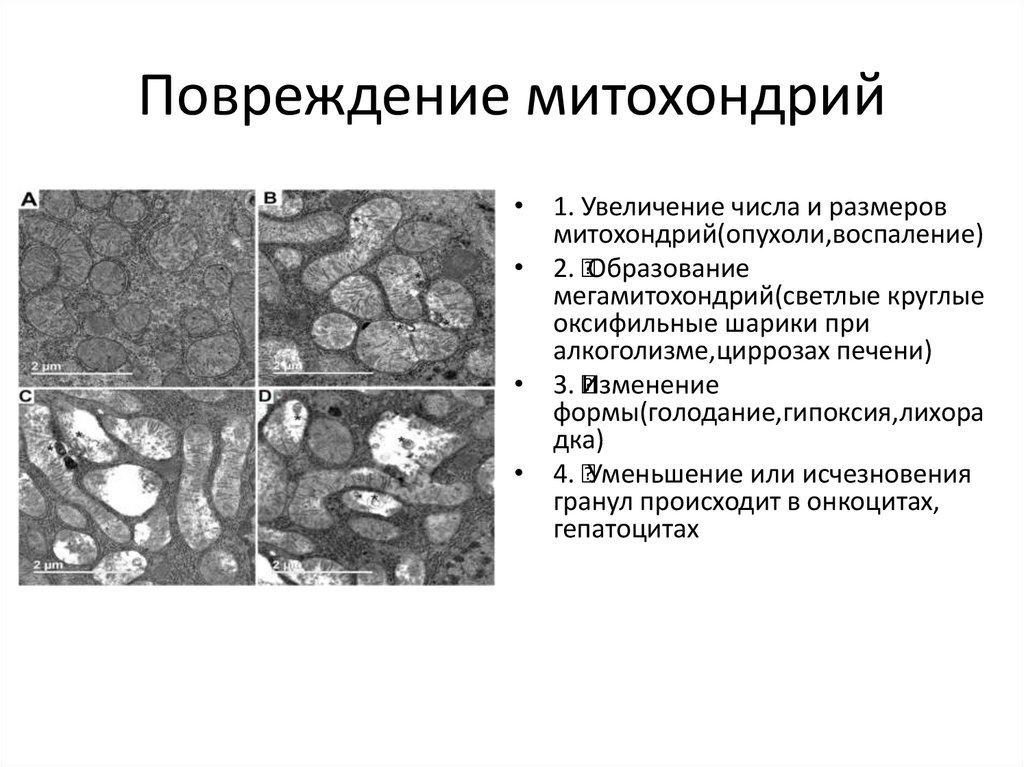 Повреждение митохондрий