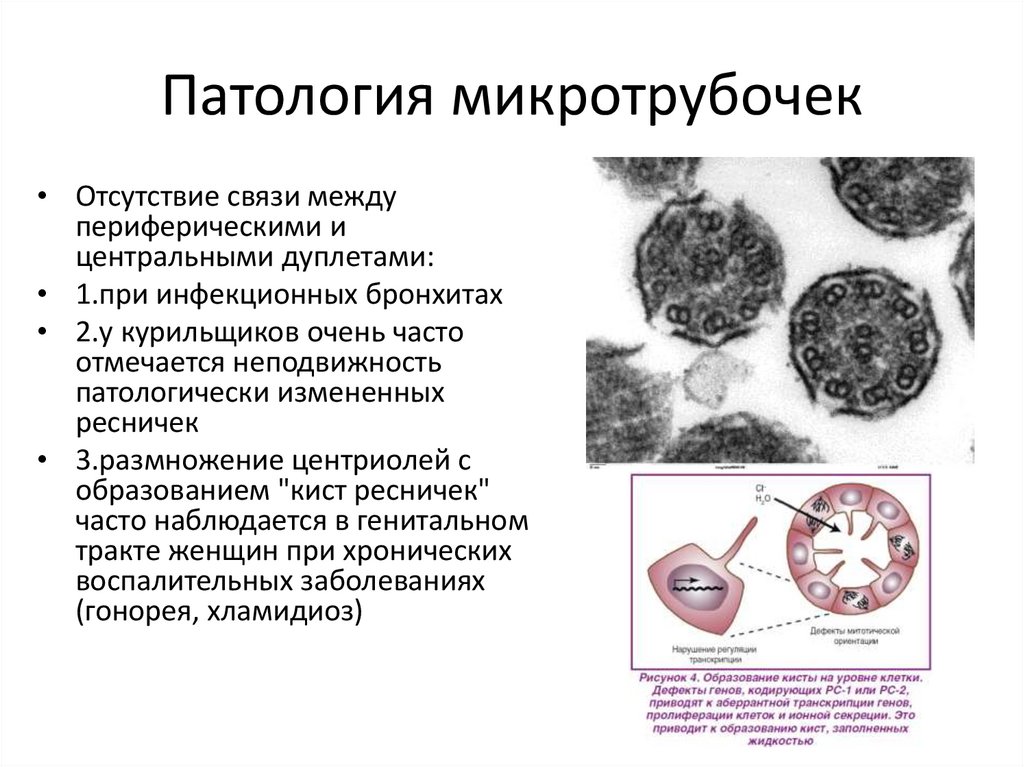 Патология микротрубочек