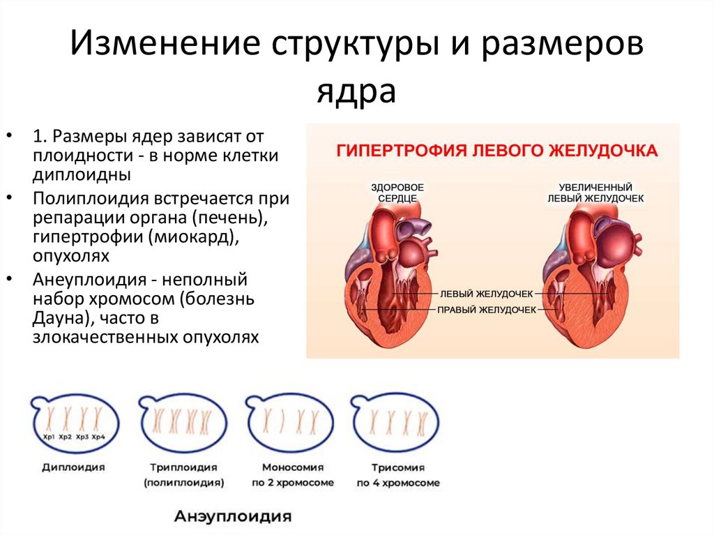 Изменение структуры и размеров ядра