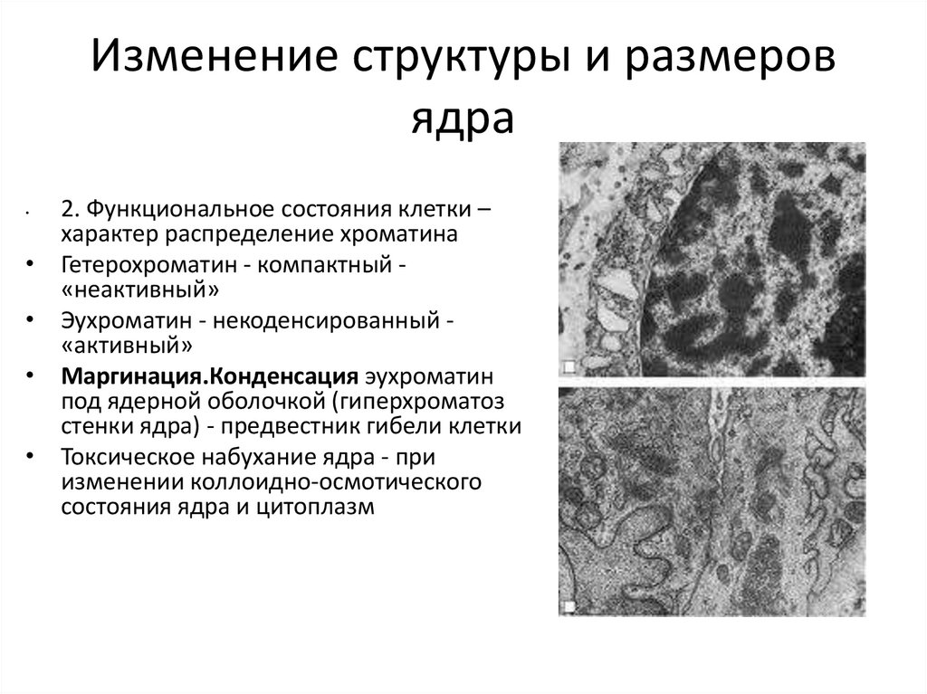 Изменение структуры и размеров ядра