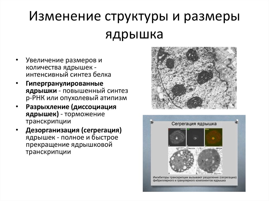 Изменение структуры и размеры ядрышка