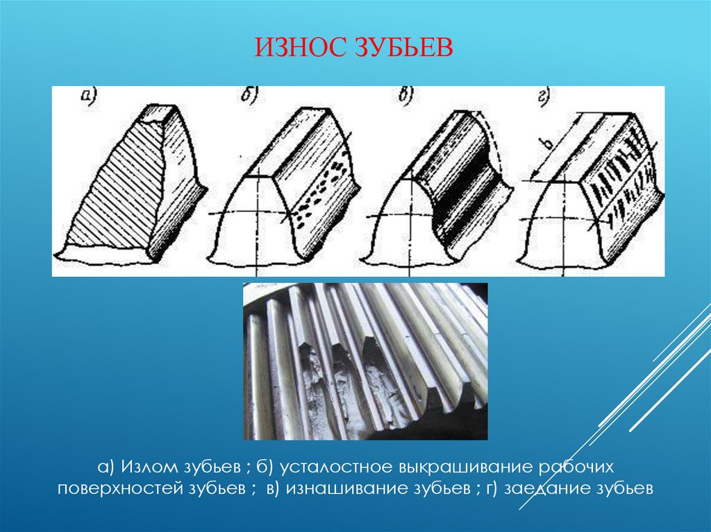 Износ зубьев