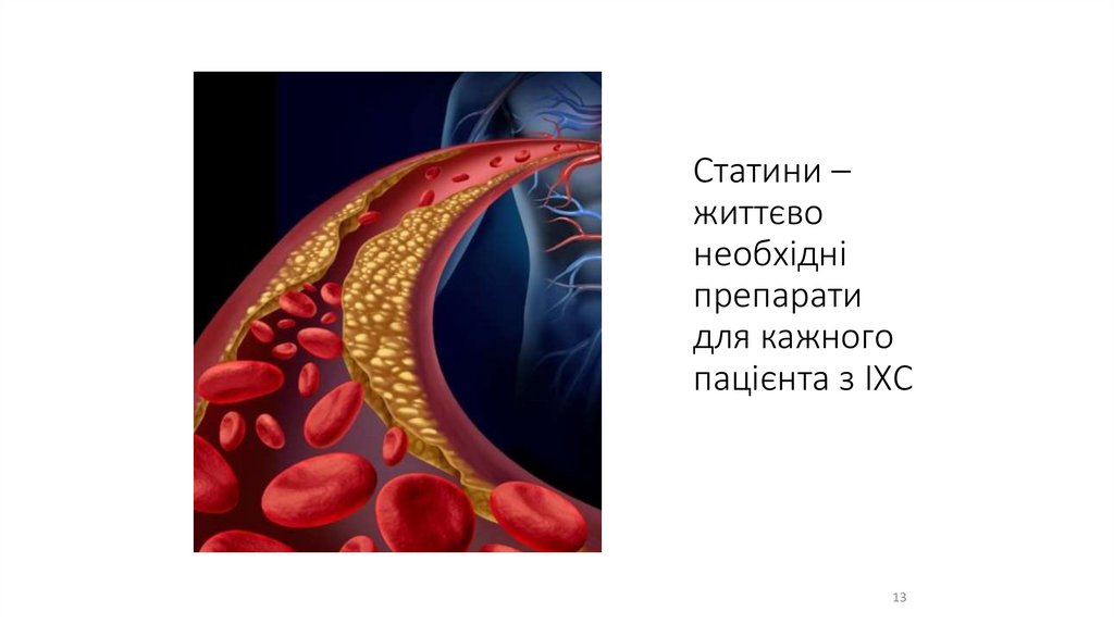 Статини – життєво необхідні препарати для кажного пацієнта з ІХС