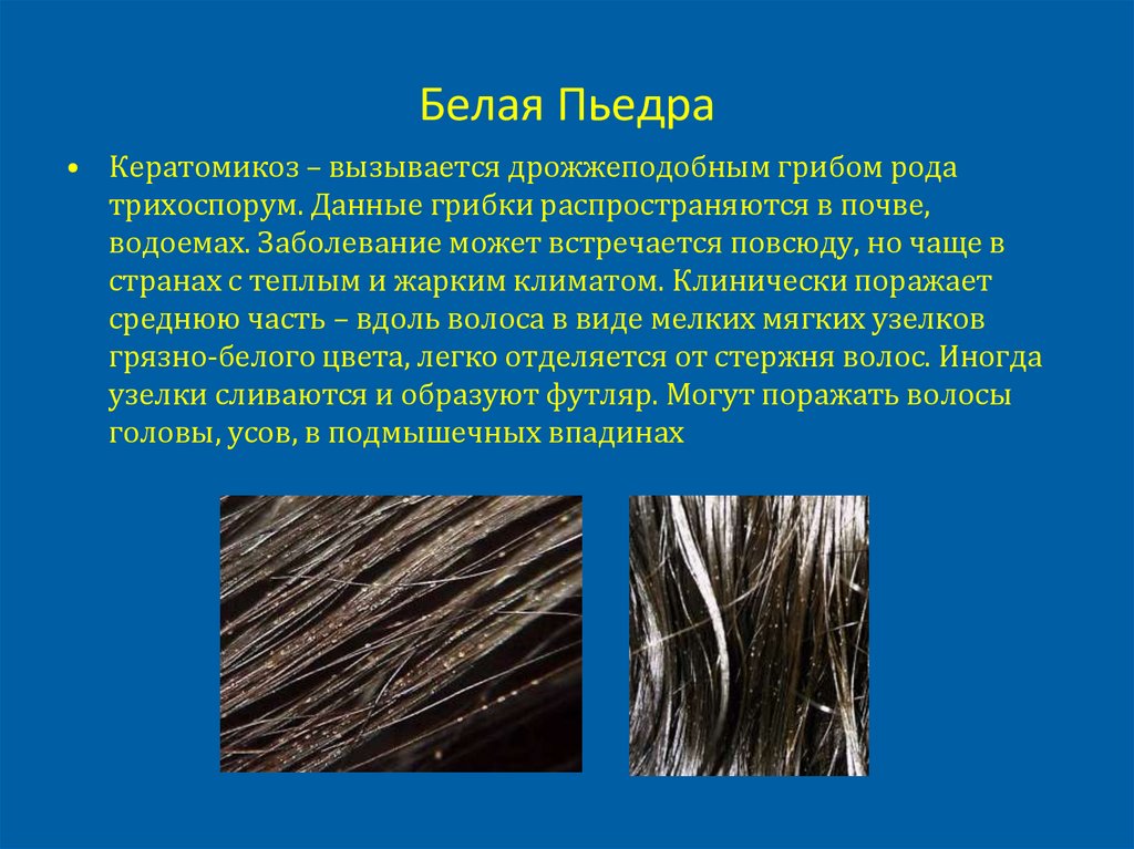 Белая Пьедра