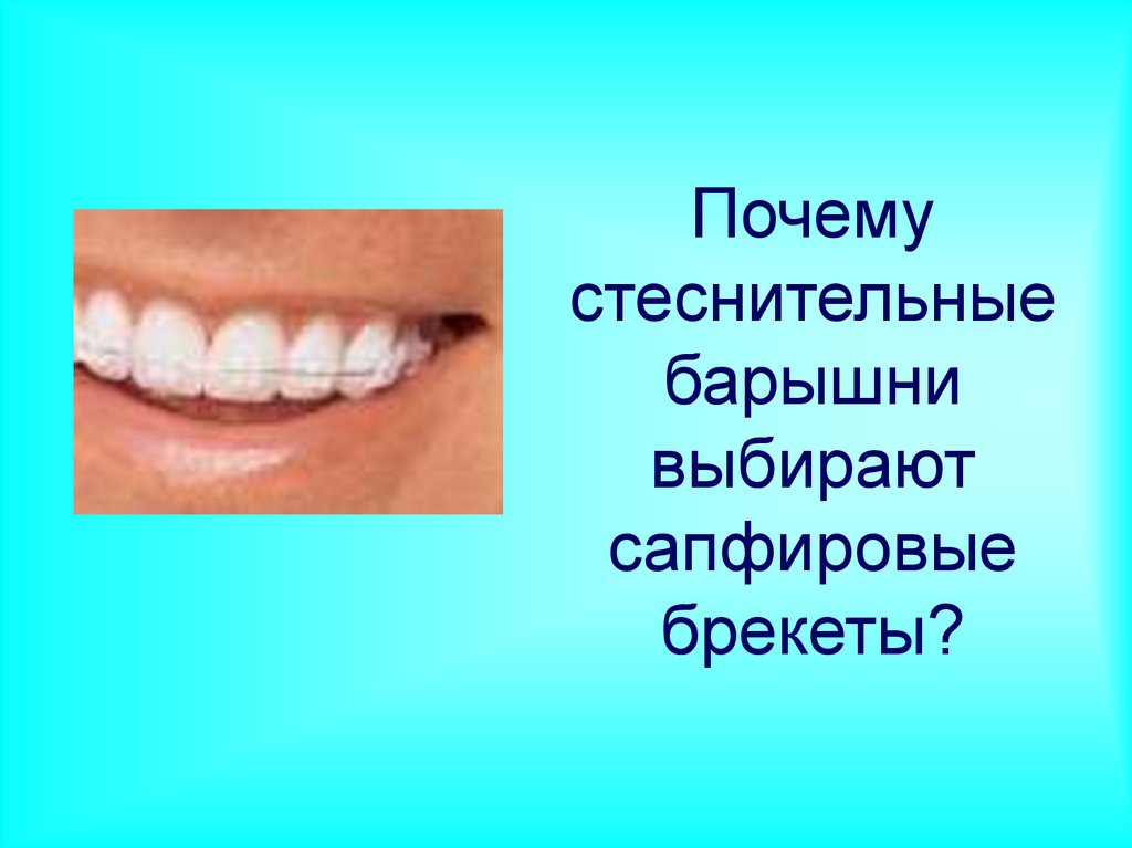 Почему стеснительные барышни выбирают сапфировые брекеты?
