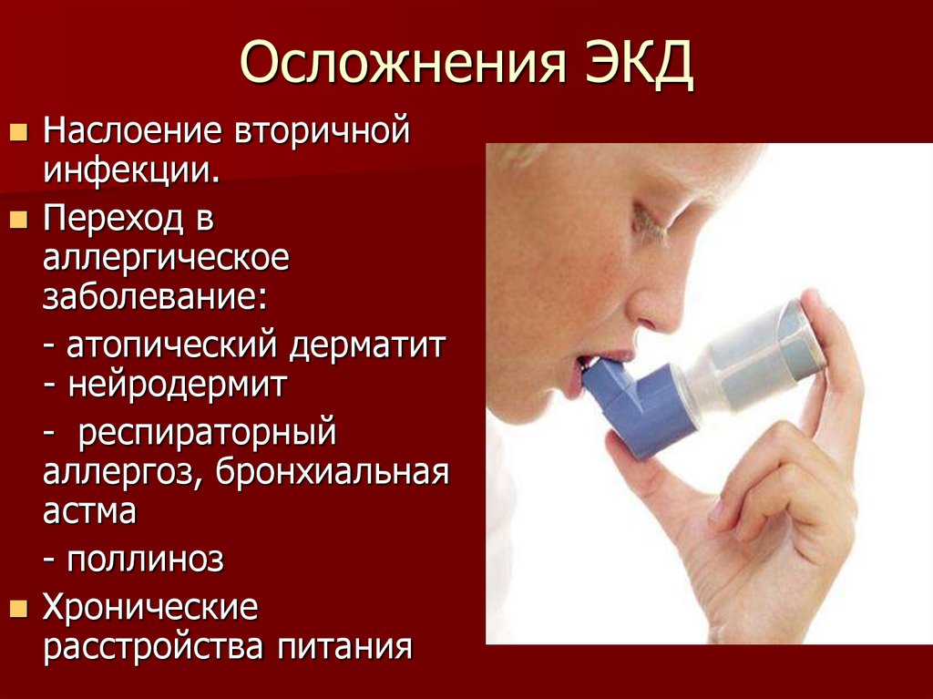 Осложнения ЭКД