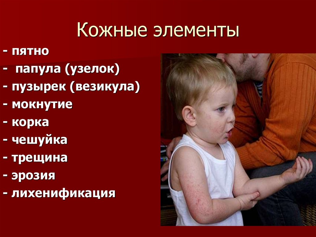 Кожные элементы