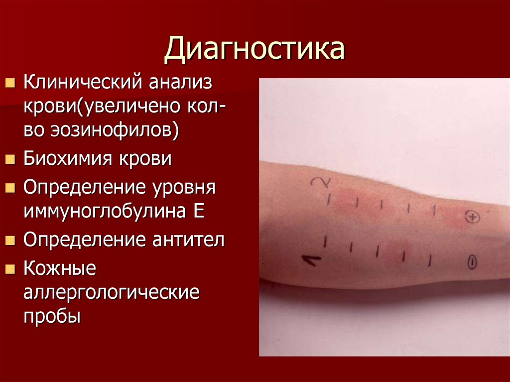 Диагностика