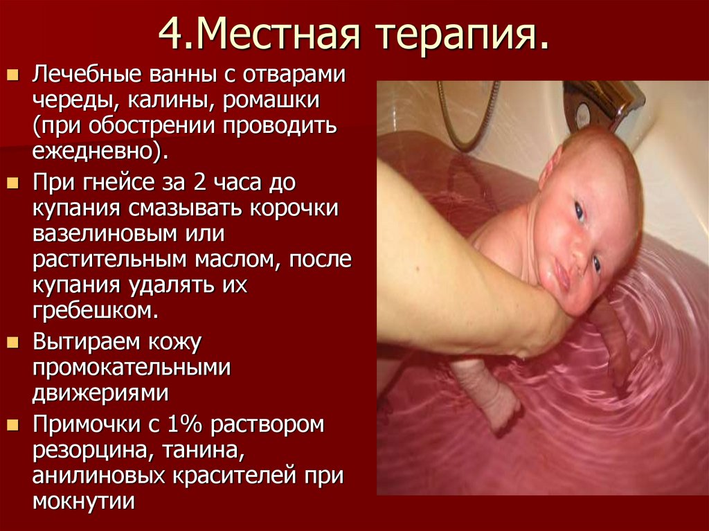 4.Местная терапия.